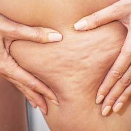 Essential Oils to Get Rid of Cellulite