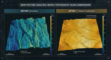 A micro-topography scan image of human skin, showing a 'before and after' comparison side-by-side. The left side (before) shows deeper lines and uneven texture, colored in cool blues and greens. The right side (after 12 weeks of treatment) shows significantly shallower lines and smoother texture, colored in warmer yellows and oranges. The image is highly technical and analytical, resembling a scientific data visualization.